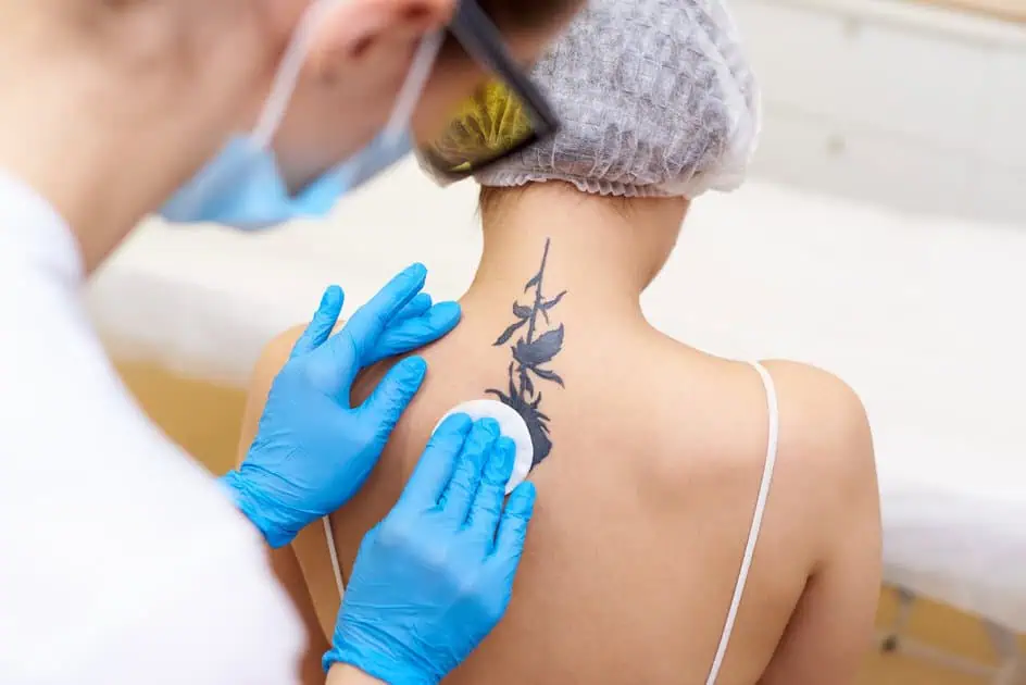 Tattoo Removal by Northwest Beauty and Wellness in , Sequim, WA